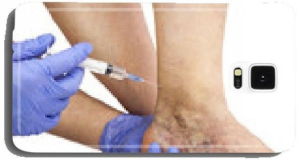 Amazon создала бот для чехлов смартфонов, но тот обезумел | - «Интернет и связь» Amazon создала бот для чехлов смартфонов, но тот обезумел | - «Интернет и связь»