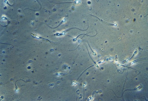 Ученые предупредили об опасном обеднении спермы у жителей развитых стран | 42.TUT.BY - «Интернет и связь»