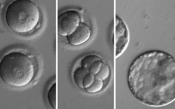 Ученые впервые удалили "больной" ген из ДНК человеческого эмбриона | 42.TUT.BY - «Интернет и связь»
