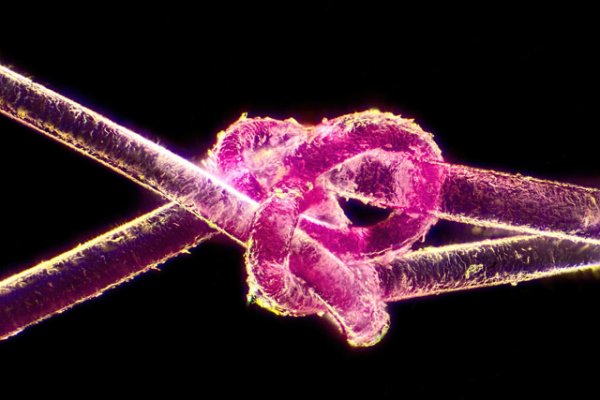 То, что скрыто от глаз: лучшие фото под микроскопом | - «Интернет и связь» То, что скрыто от глаз: лучшие фото под микроскопом | - «Интернет и связь»